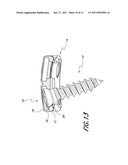 BONE PLATE SYSTEM AND METHODS OF USING THE SAME diagram and image