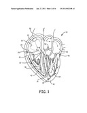 SYSTEM AND METHOD OF AV INTERVAL SELECTION IN AN IMPLANTABLE MEDICAL DEVICE diagram and image