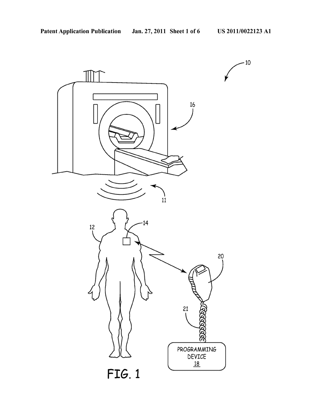 IMPLANTABLE MEDICAL DEVICE WITH INDUCTIVE ANTENNA FILTER - diagram, schematic, and image 02