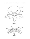 MULTIPLEXED MULTI-ELECTRODE NEUROSTIMULATION DEVICES diagram and image