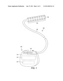 TUBULAR LEAD ANCHOR AND METHODS AND DEVICES USING THE ANCHOR diagram and image