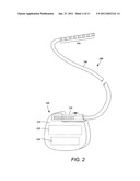 TUBULAR LEAD ANCHOR AND METHODS AND DEVICES USING THE ANCHOR diagram and image