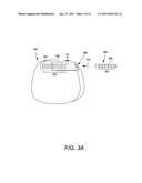 TUBULAR LEAD ANCHOR AND METHODS AND DEVICES USING THE ANCHOR diagram and image