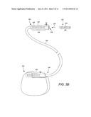 TUBULAR LEAD ANCHOR AND METHODS AND DEVICES USING THE ANCHOR diagram and image