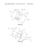 TUBULAR LEAD ANCHOR AND METHODS AND DEVICES USING THE ANCHOR diagram and image