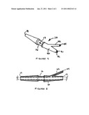 Spinal cord stimulation lead anchor diagram and image