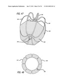 METHODS AND DEVICES FOR TREATMENT OF VASCULAR DEFECTS diagram and image