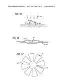 METHODS AND DEVICES FOR TREATMENT OF VASCULAR DEFECTS diagram and image