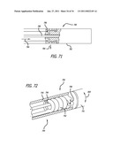 METHODS AND DEVICES FOR TREATMENT OF VASCULAR DEFECTS diagram and image