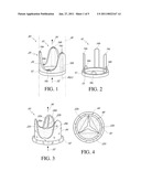 INTRAPARIETAL AORTIC VALVE REINFORCEMENT DEVICE AND A REINFORCED BIOLOGICAL AORTIC VALVE diagram and image