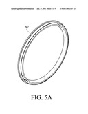 INTRAPARIETAL AORTIC VALVE REINFORCEMENT DEVICE AND A REINFORCED BIOLOGICAL AORTIC VALVE diagram and image