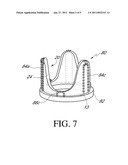 INTRAPARIETAL AORTIC VALVE REINFORCEMENT DEVICE AND A REINFORCED BIOLOGICAL AORTIC VALVE diagram and image