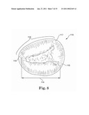 Annuloplasty Device for Tricuspid Valve Repair diagram and image