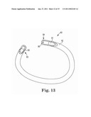 Annuloplasty Device for Tricuspid Valve Repair diagram and image