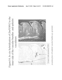 METHODS FOR IMPROVING CROP PLANT ARCHITECTURE AND YIELD diagram and image