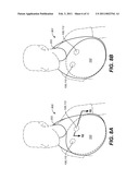 BIB diagram and image