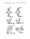 INTERNAL COMBUSTION ENGINE WITH VARIABLE COMPRESSION RATIO diagram and image