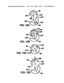 INTERNAL COMBUSTION ENGINE WITH VARIABLE COMPRESSION RATIO diagram and image