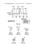 INTERNAL COMBUSTION ENGINE WITH VARIABLE COMPRESSION RATIO diagram and image