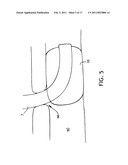 Subglottic Suctioning System diagram and image