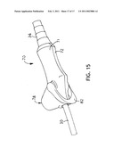 Subglottic Suctioning System diagram and image