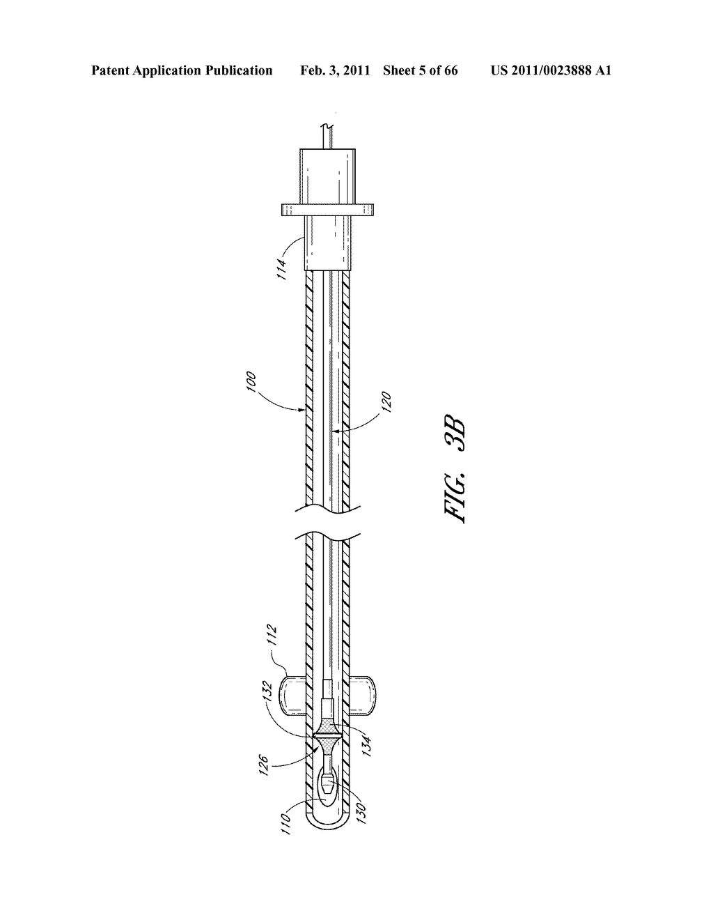 METHODS FOR REMOVING DEBRIS FROM MEDICAL TUBES - diagram, schematic, and image 06