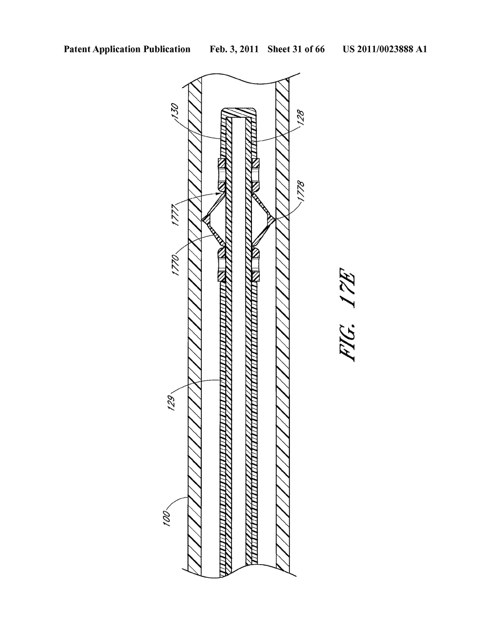 METHODS FOR REMOVING DEBRIS FROM MEDICAL TUBES - diagram, schematic, and image 32