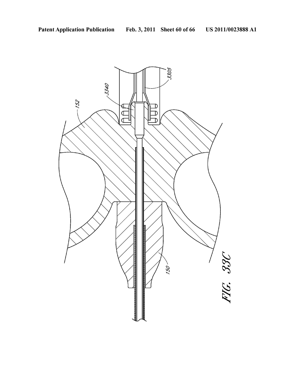 METHODS FOR REMOVING DEBRIS FROM MEDICAL TUBES - diagram, schematic, and image 61