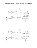 Nasal Support Device and Method diagram and image