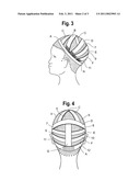 Hair Integration Assembly diagram and image