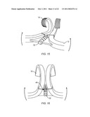 Garland Hanger diagram and image