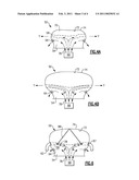 DYNAMIC AIRBAG VENTING diagram and image