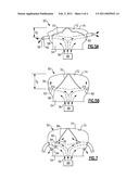 DYNAMIC AIRBAG VENTING diagram and image