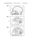 METHOD AND DEVICE FOR DISPLAYING COMPUTED-TOMOGRAPHY EXAMINATION DATA FROM AN EXAMINATION OBJECT diagram and image