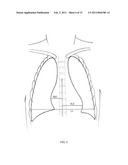 Method of Segmenting Anatomic Entities in Digital Medical Images diagram and image