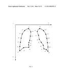 Method of Segmenting Anatomic Entities in Digital Medical Images diagram and image