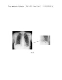 Method of Segmenting Anatomic Entities in Digital Medical Images diagram and image