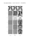 Method of Segmenting Anatomic Entities in Digital Medical Images diagram and image