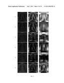 Method of Segmenting Anatomic Entities in Digital Medical Images diagram and image