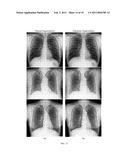 Method of Segmenting Anatomic Entities in Digital Medical Images diagram and image