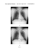 Method of Segmenting Anatomic Entities in Digital Medical Images diagram and image