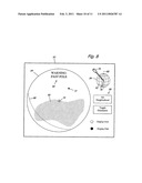 METHOD FOR DEALING WITH SINGULARITIES IN GRAVITY REFERENCED ENDOSCOPIC IMAGING diagram and image