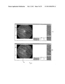 RETINAL IMAGE ANALYSIS SYSTEMS AND METHODS diagram and image