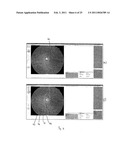 RETINAL IMAGE ANALYSIS SYSTEMS AND METHODS diagram and image