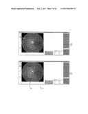 RETINAL IMAGE ANALYSIS SYSTEMS AND METHODS diagram and image