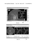 RETINAL IMAGE ANALYSIS SYSTEMS AND METHODS diagram and image