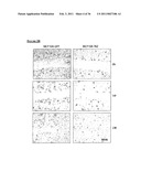 TAZ/WWTR1 FOR DIAGNOSIS AND TREATMENT OF CANCER diagram and image