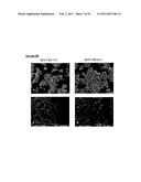 TAZ/WWTR1 FOR DIAGNOSIS AND TREATMENT OF CANCER diagram and image