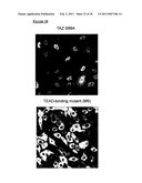 TAZ/WWTR1 FOR DIAGNOSIS AND TREATMENT OF CANCER diagram and image