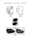 Methods and Compositions Related to Immunizing Against Staphylococcal Lung Diseases and Conditions diagram and image